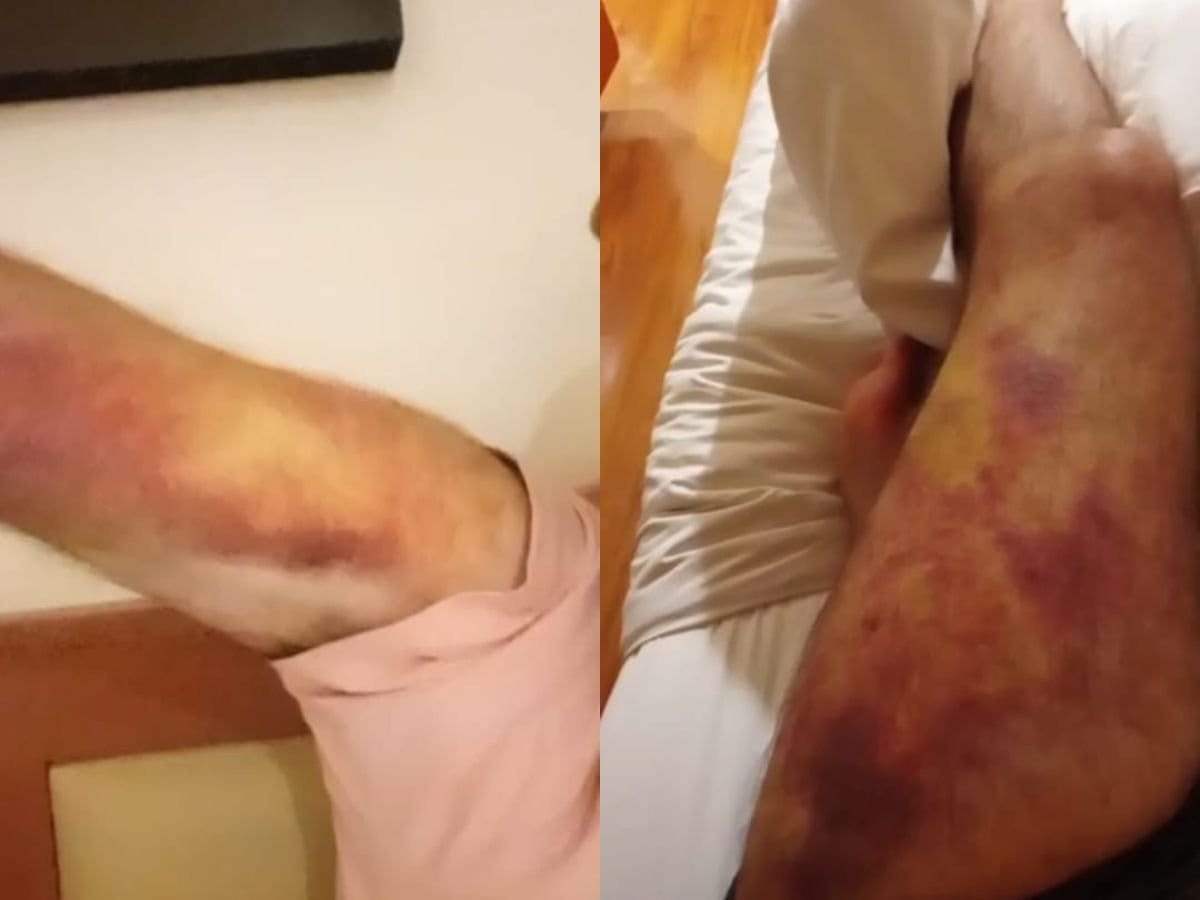 Jovem vítima de tráfico humano revela que foi torturado para enganar brasileiros Jovem vítima de tráfico humano revela que foi torturado para enganar brasileiros