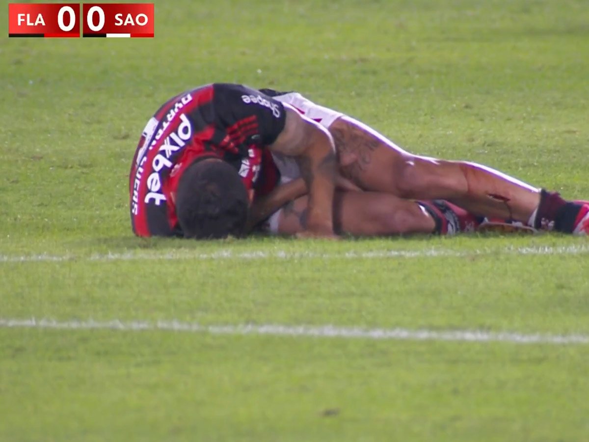 Ayrton Lucas sofre ferimento grave e fica com osso à mostra em jogo do Flamengo Ayrton Lucas sofre ferimento grave e fica com osso à mostra em jogo do Flamengo