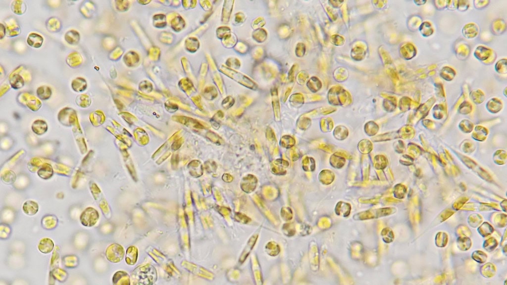 Diatomáceas em um microscópio